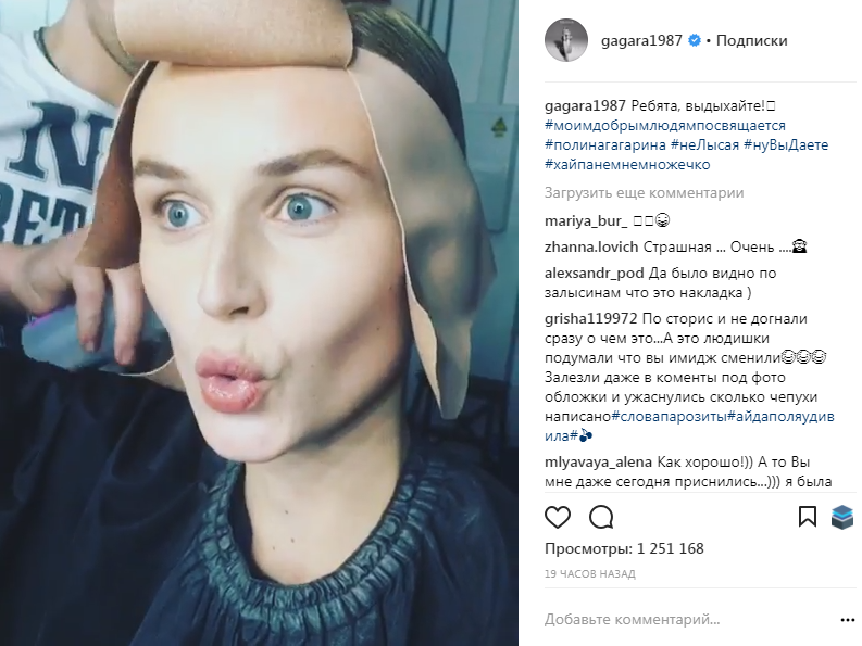 Полина Гагарина показала, как&nbsp;лишилась волос